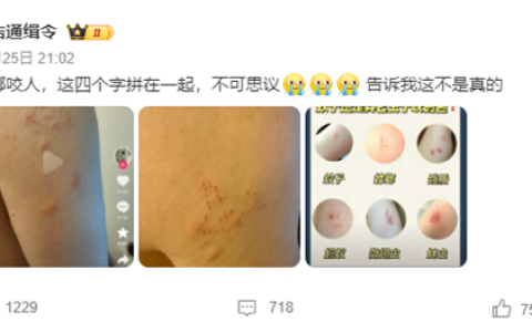 “蟑螂咬人”上热搜 《博物杂志》分析辟谣：三种可能
