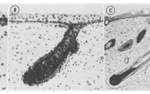 为什么每个人的头发都有“旋” 两个旋真的更聪明么