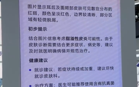 博主坦言美国看病太贵太麻烦：想把中国的AI医生带回去