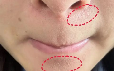 真的想问：下巴凸起的小颗粒 到底是什么呀！