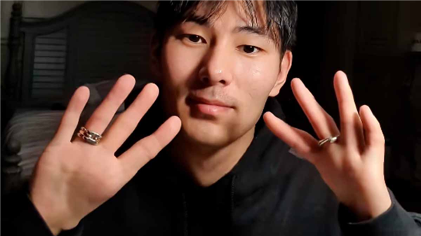 男子天生缺少拇指 用4指开瓶盖喝水走红