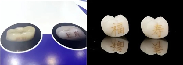 “发财”“上岸”刻牙上 牙齿上刻字成新玄学！专家：不建议