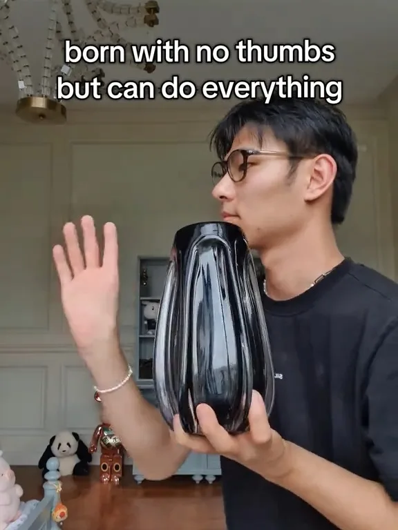 男子天生缺少拇指 用4指开瓶盖喝水走红
