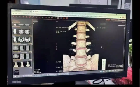 小伙学冲浪闪了腰致截瘫：确诊罕见病“冲浪者脊髓病”