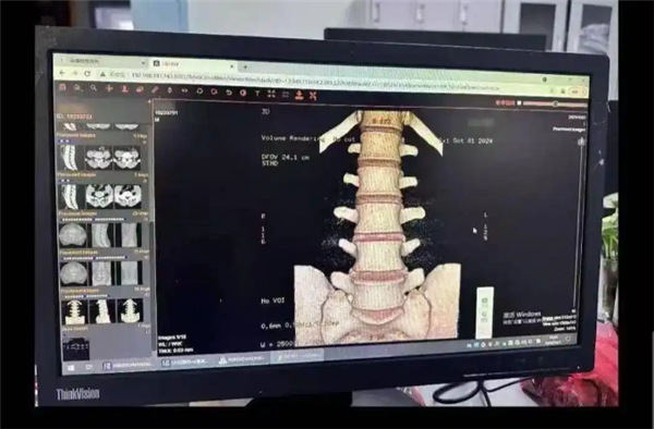 小伙学冲浪闪了腰致截瘫：确诊罕见病“冲浪者脊髓病”
