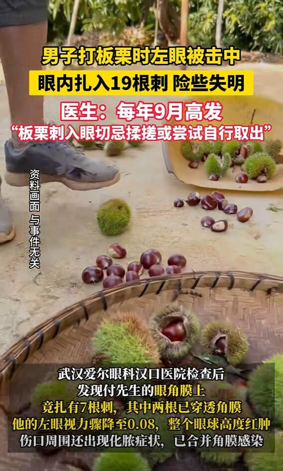男子打板栗：左眼扎入19根刺险失明
