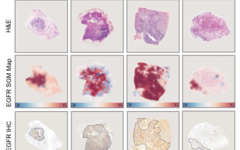 1分钟内完成！腾讯AI实现肺癌基因突变预测：精度最高可达99%