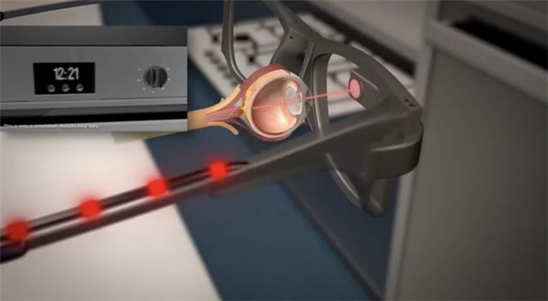 英国研发出PRIMA电子眼：临床试验84%失明患者恢复阅读能力