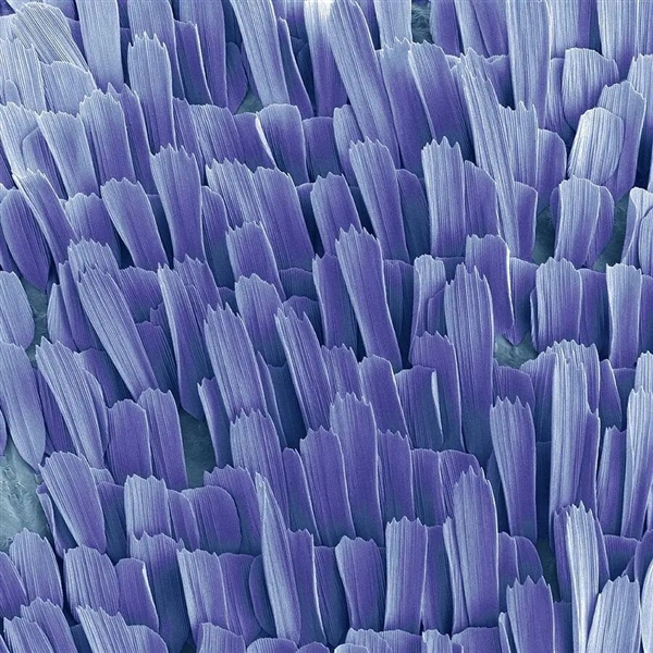 被放大的飞蛾鳞片惊到了