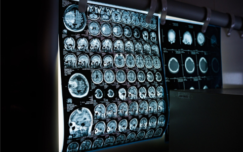 看病正在告别胶片时代！广东建设影像云平台：多家三甲医院影像云索引共享