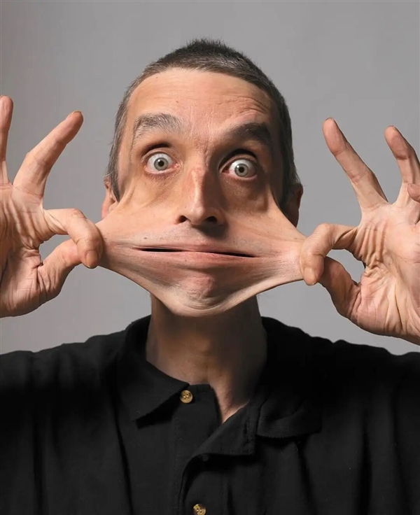 世界上皮肤最有“弹性”的男子 看完可能整个人都不好了