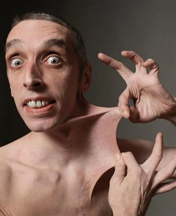 世界上皮肤最有“弹性”的男子 看完可能整个人都不好了