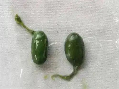 女子生吞鱼胆降火导致肝衰竭 医生：毒性堪比砒霜 无解药