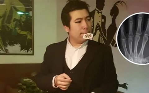 美国魔术师手掌植入芯片 但他忘记了密码