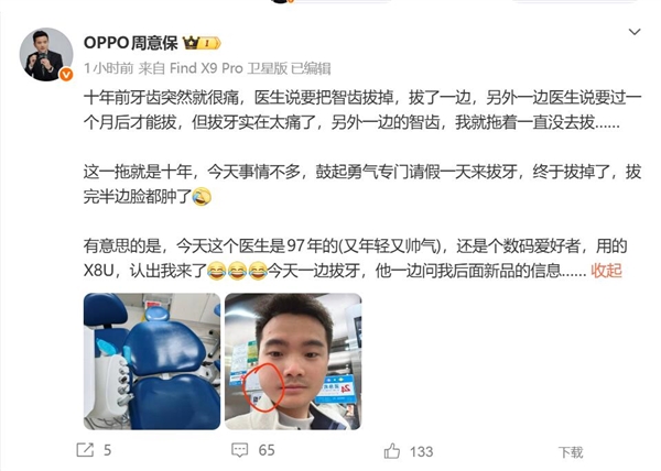 OPPO周意保去拔牙 牙医是O粉:一边拔牙一边问新机消息