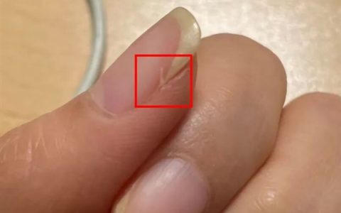 指甲为什么总从这个地方断开 是缺钙了吗