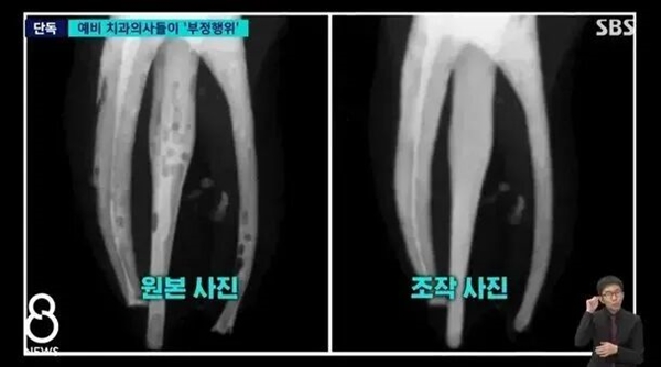 韩国顶尖大学出现集体作弊：近60%学生用PS修X光片
