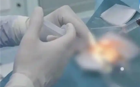38岁女子宅家熬夜刷手机 眼压飙升诱发青光眼险失明