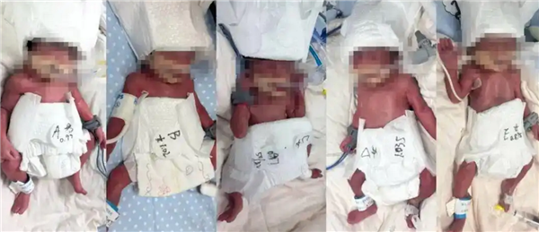 新疆24岁女子成功诞下1男4女5胞胎引全网祝福：堪称生命的极致奇迹