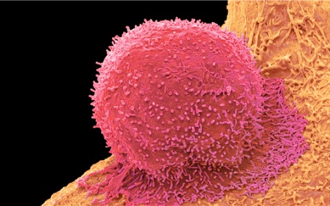 研究发现大腿粗的人或自带抗癌优势：这才是宝藏身材