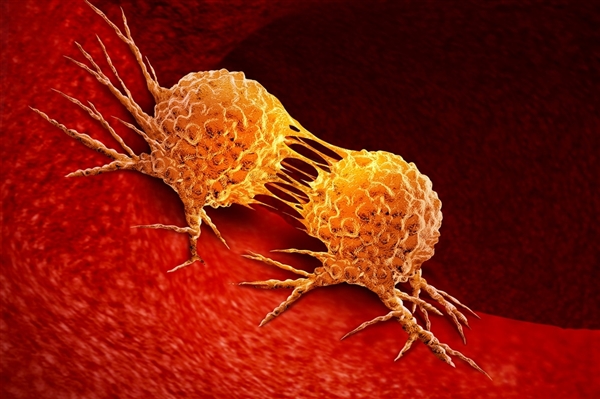 胰腺癌治疗迎重大突破：Revolution Medicines靶向药III期试验成功 患者生存期接近翻倍