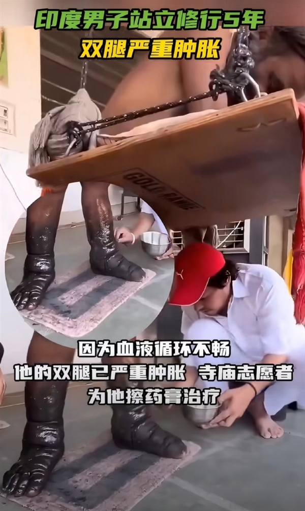站立五年不坐不躺!印度苦行僧双腿严重发黑肿胀 还要再熬7年